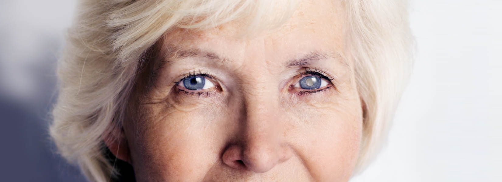 Cataract Surgery in Mifflintown